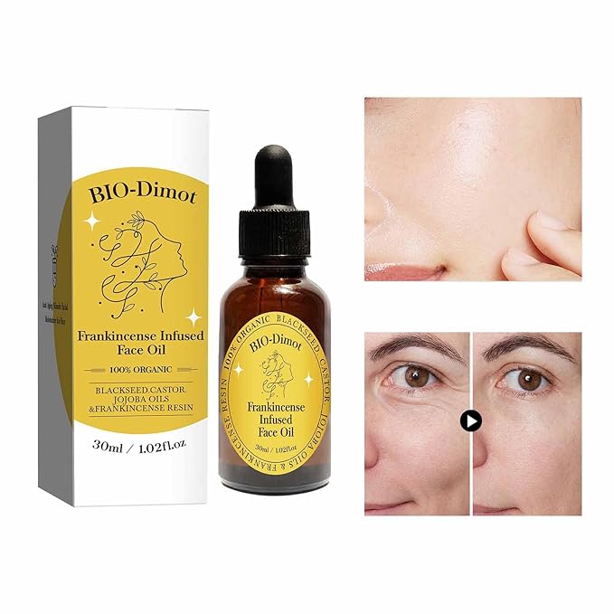 Frankincense Resin Oil, Natural Castor and Jojoba Oils Cold Pressed Serum Face Hydrates Anti-Aging Organic Frankincense Oil. -2Pcs