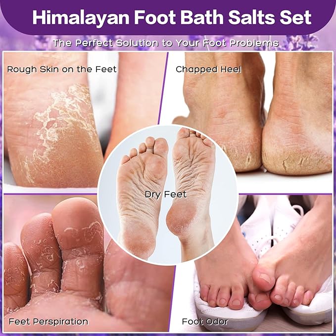 Himalayan Pink Salt Kit Pack of 2 Natural Foot Soak Salts Epsom Salt Essential Oils Lavender Orange Rose Scent Dead Sea Salt Moisturizing Skin Tea Tree Oil Foot Care Pedicure